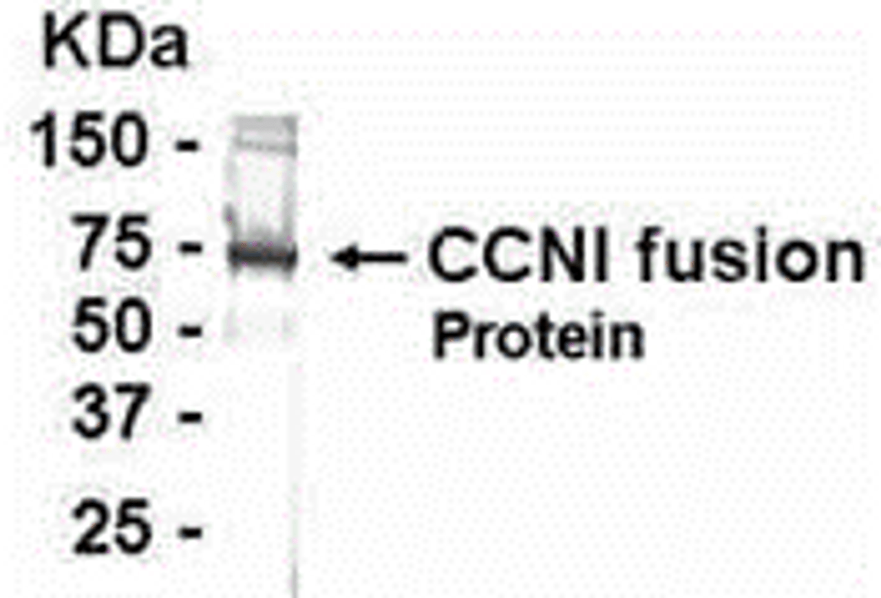 E coli-derived fusion protein as test antigen. Affinity-purified IgY dilution: 1:2000, Goat anti-IgY-HRP dilution: 1:1000. Colorimetric method for signal development.