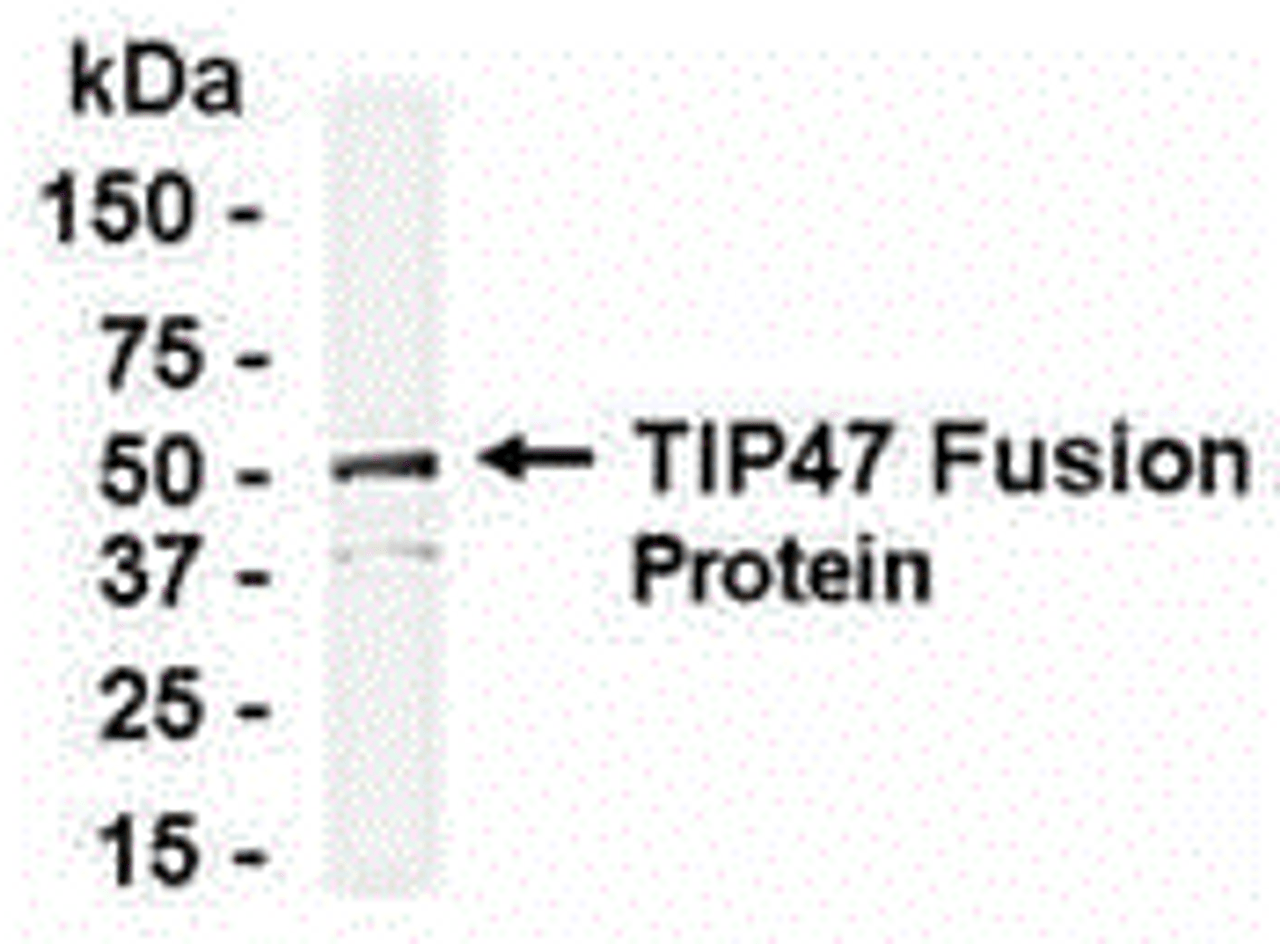 E coli-derived fusion protein as test antigen. Affinity-purified IgY dilution: 1:2000, Goat anti-IgY-HRP dilution: 1:1000. Colorimetric method for signal development.