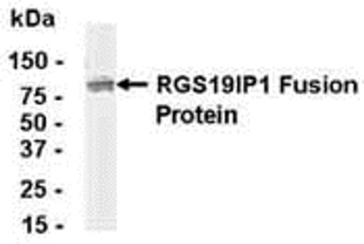 E coli-derived fusion protein as test antigen. Affinity-purified IgY dilution: 1:2000, Goat anti-IgY-HRP dilution: 1:1000. Colorimetric method for signal development.