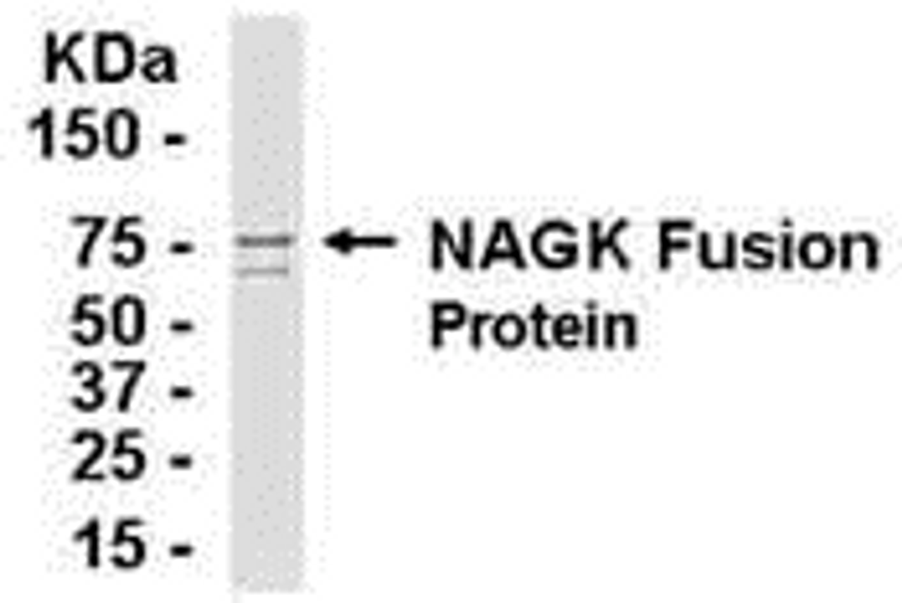 E coli-derived fusion protein as test antigen. Affinity-purified IgY dilution: 1:2000, Goat anti-IgY-HRP dilution: 1:1000. Colorimetric method for signal development.