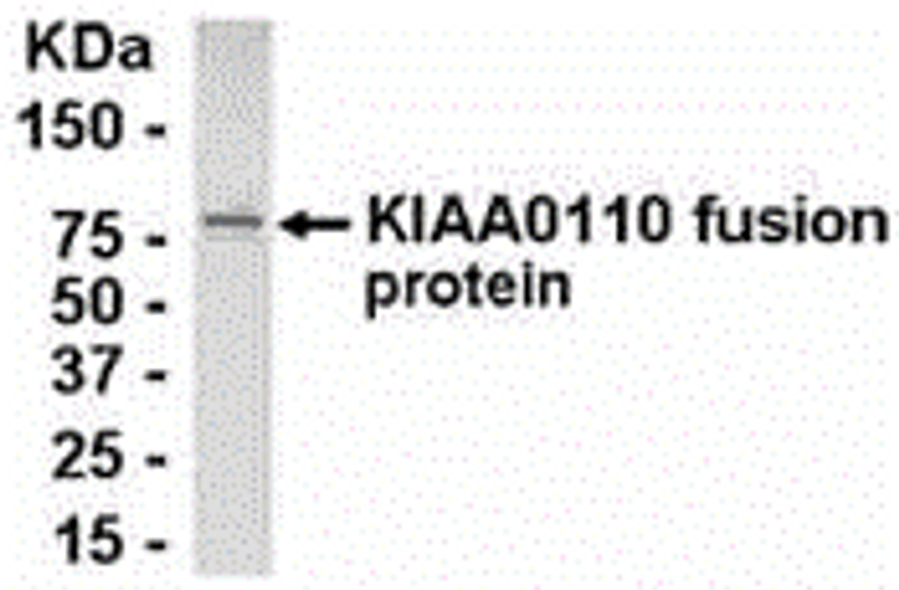 E coli-derived fusion protein as test antigen. Affinity-purified IgY dilution: 1:2000, Goat anti-IgY-HRP dilution: 1:1000. Colorimetric method for signal development.