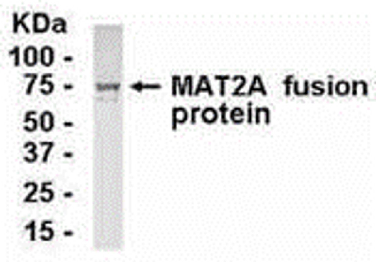 E coli-derived fusion protein as test antigen. Affinity-purified IgY dilution: 1:2000, Goat anti-IgY-HRP dilution: 1:1000. Colorimetric method for signal development.