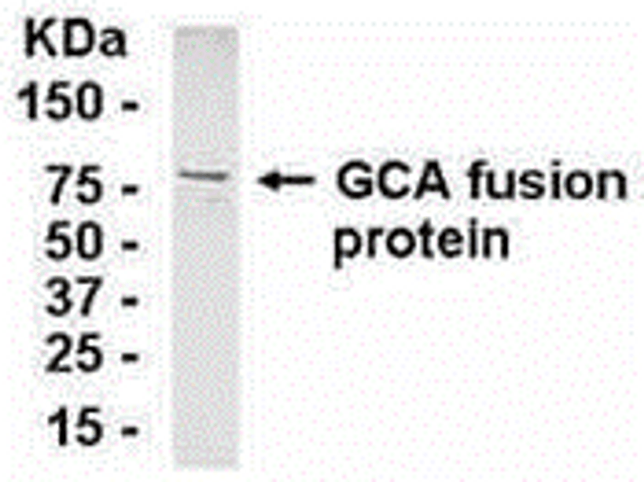 E coli-derived fusion protein as test antigen. Affinity-purified IgY dilution: 1:2000, Goat anti-IgY-HRP dilution: 1:1000. Colorimetric method for signal development.