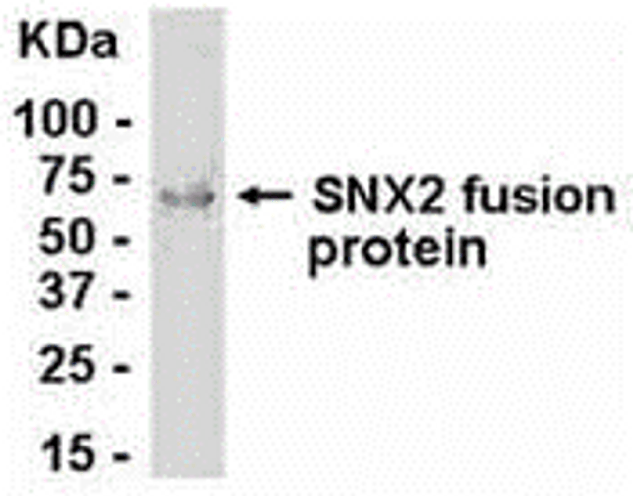 E coli-derived fusion protein as test antigen. Affinity-purified IgY dilution: 1:2000, Goat anti-IgY-HRP dilution: 1:1000. Colorimetric method for signal development.