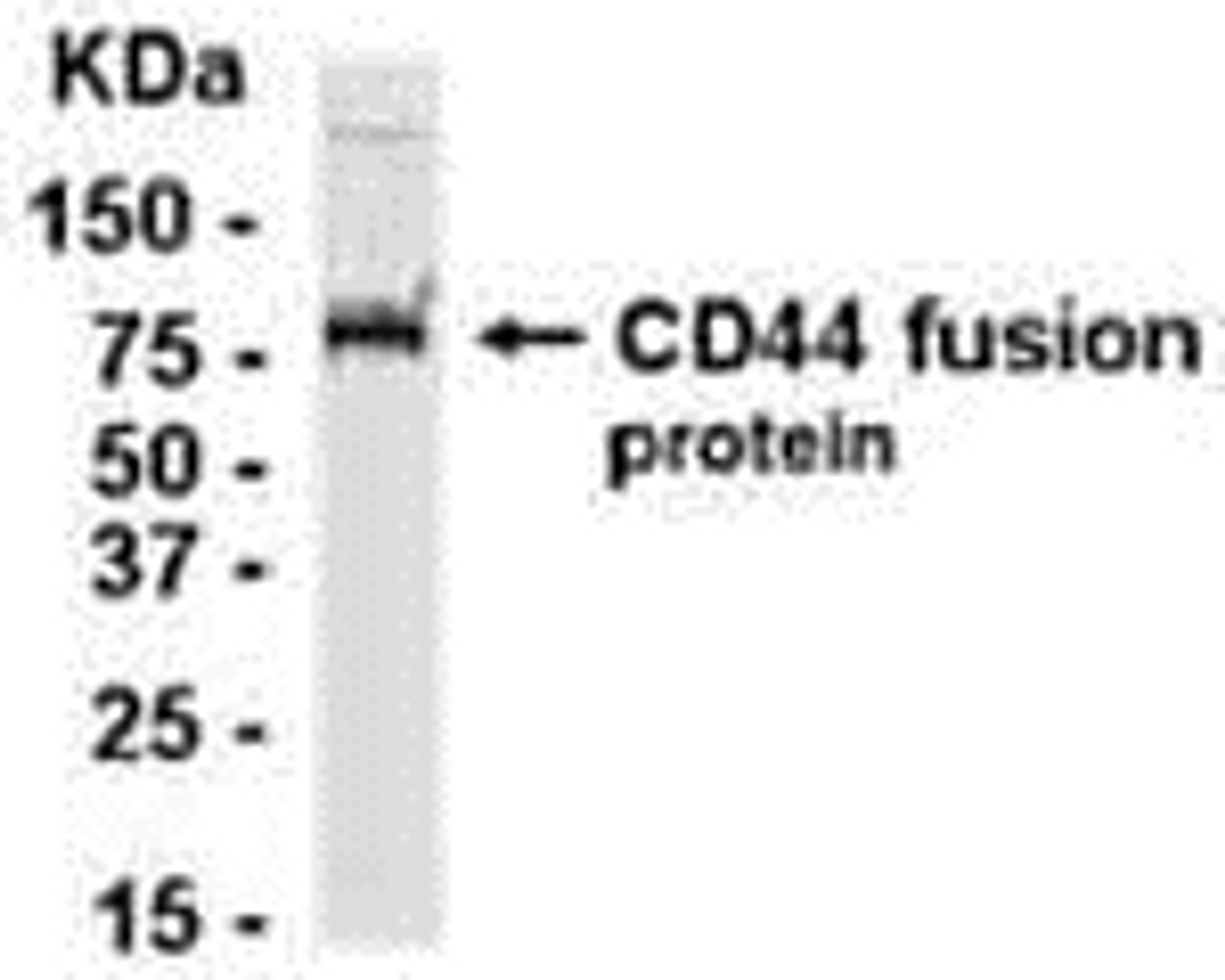 E coli-derived fusion protein as test antigen. Affi-pure IgY dilution: 1:2000, Goat anti-IgY-HRP dilution: 1:1000. Colorimetric method for signal development.