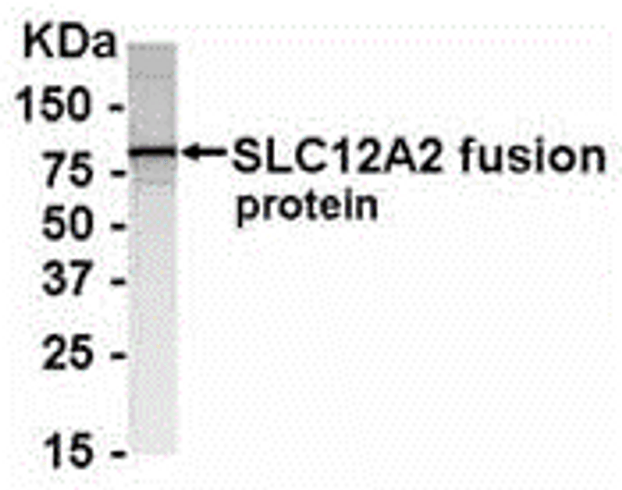 E coli-derived fusion protein as test antigen. Affinity-purified IgY dilution: 1:2000, Goat anti-IgY-HRP dilution: 1:1000. Colorimetric method for signal development.