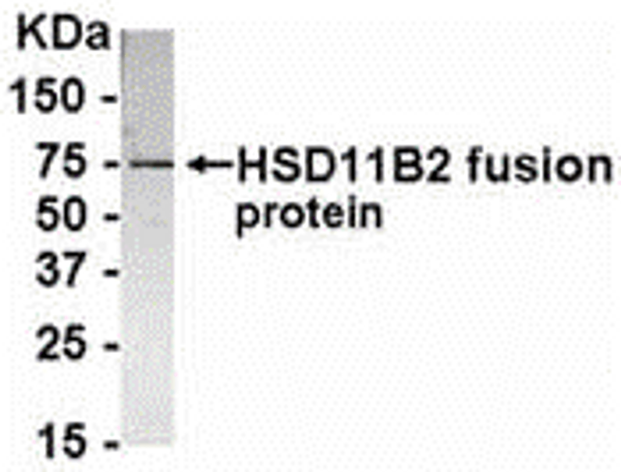 E coli-derived fusion protein as test antigen. Affinity-purified IgY dilution: 1:2000, Goat anti-IgY-HRP dilution: 1:1000. Colorimetric method for signal development.