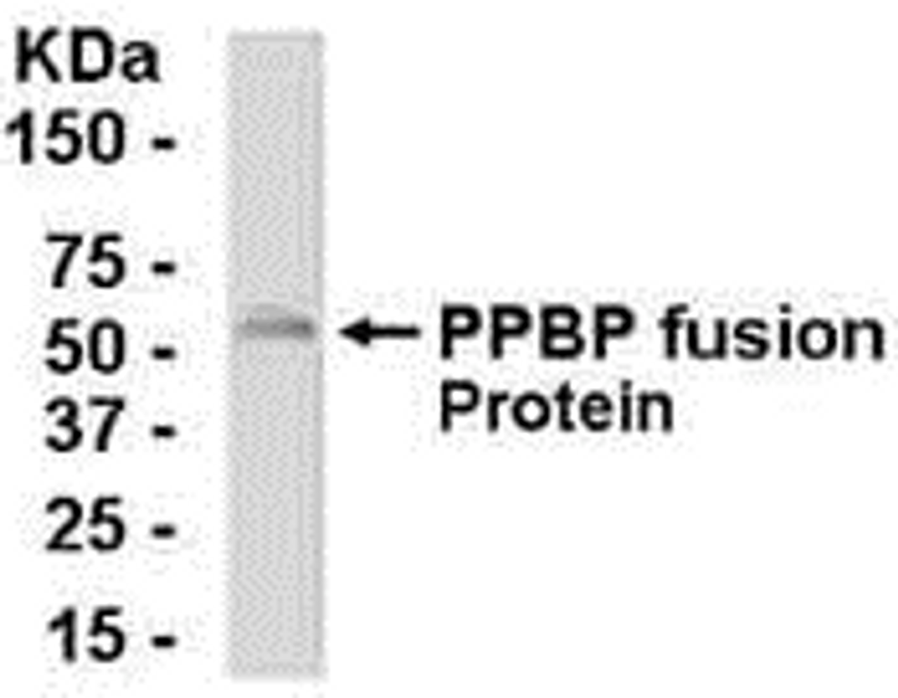 E coli-derived fusion protein as test antigen. Affinity-purified IgY dilution: 1:2000, Goat anti-IgY-HRP dilution: 1:1000. Colorimetric method for signal development.