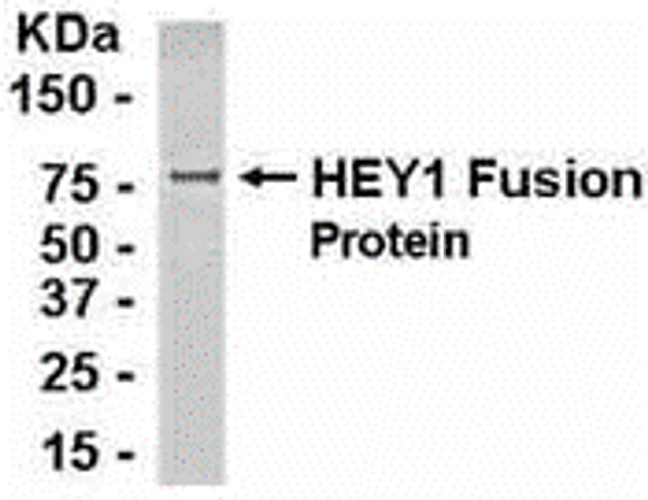 E coli-derived fusion protein as test antigen. Affinity-purified IgY dilution: 1:2000, Goat anti-IgY-HRP dilution: 1:1000. Colorimetric method for signal development.