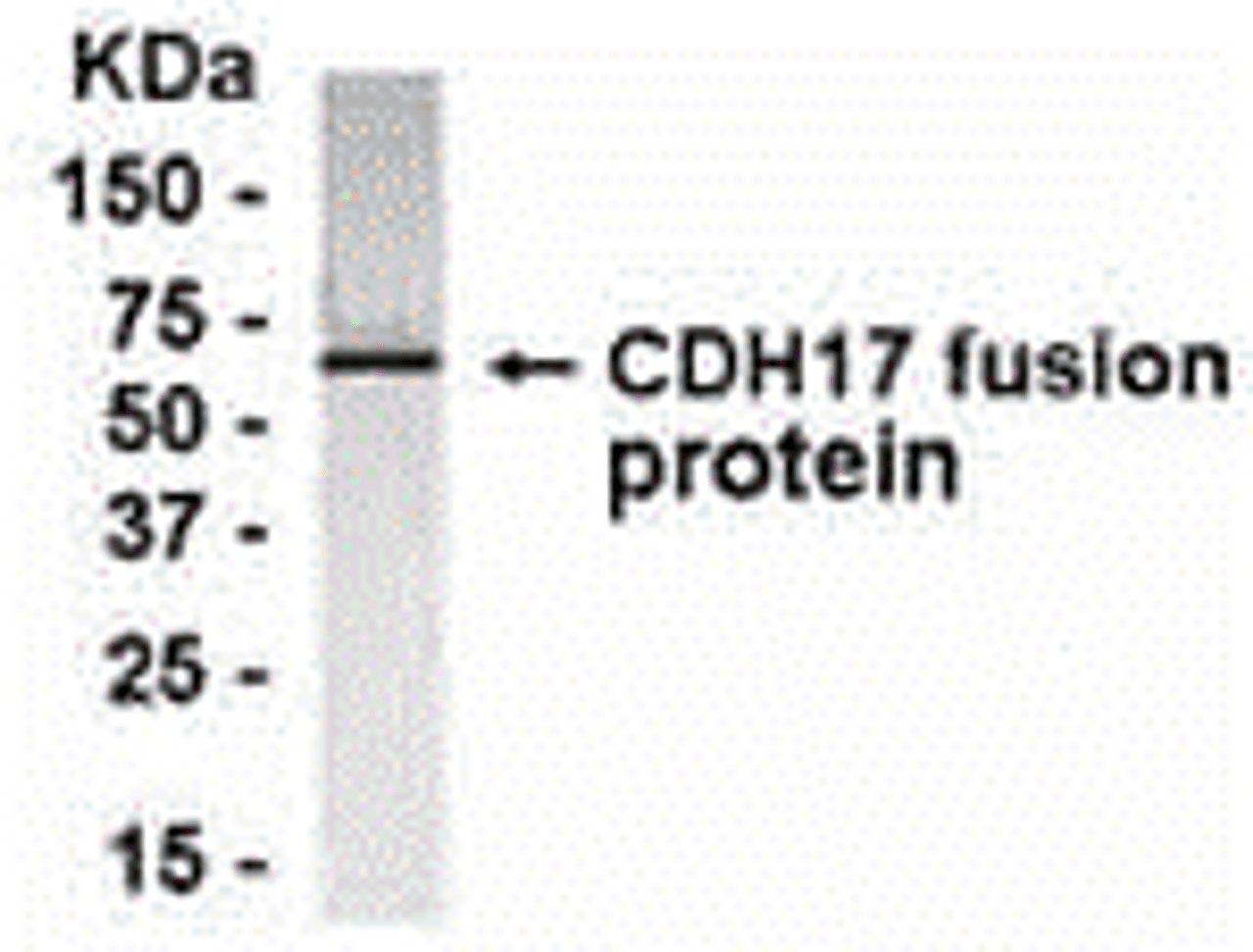 E coli-derived fusion protein as test antigen. Affinity-purified IgY dilution: 1:2000, Goat anti-IgY-HRP dilution: 1:1000. Colorimetric method for signal development.