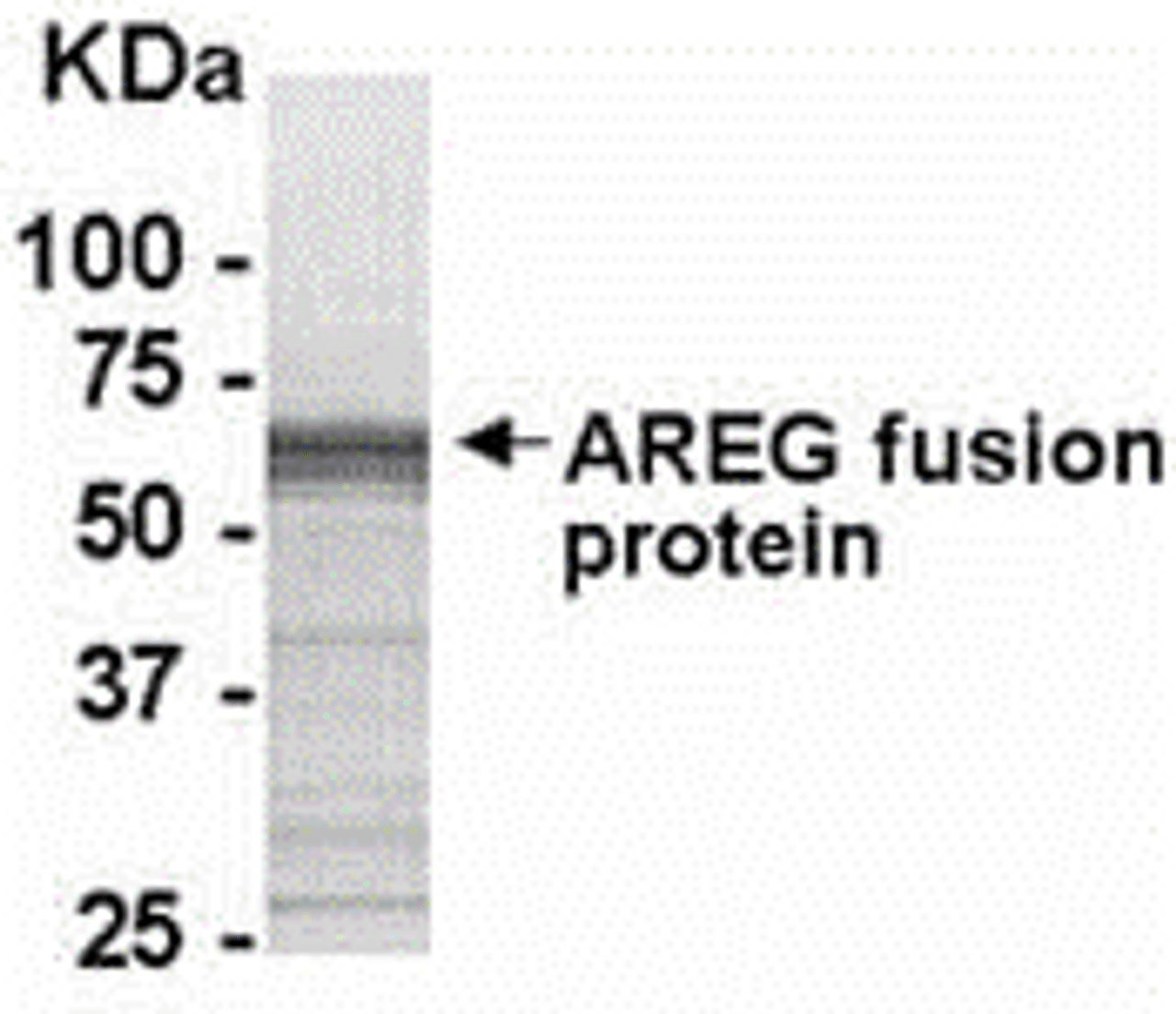 E coli-derived fusion protein as test antigen. Affinity-purified IgY dilution: 1:2000, Goat anti-IgY-HRP dilution: 1:1000. Colorimetric method for signal development.