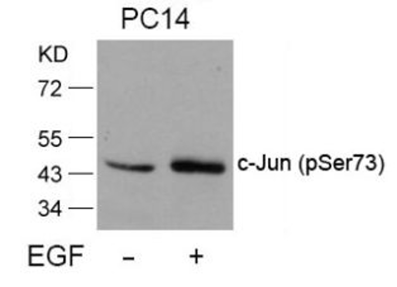 Western blot analysis of lysed extracts from PC14 cells untreated or treated with EGF using c-Jun (Phospho-Ser73) .