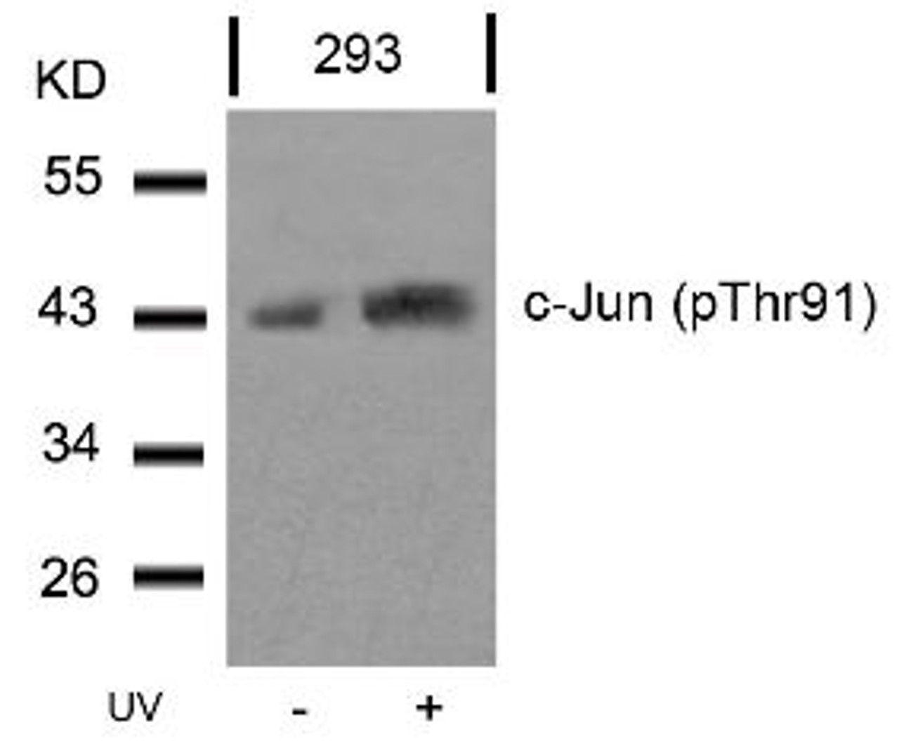 Western blot analysis of lysed extracts from 293 cells untreated or treated with UV using c-Jun (Phospho-Thr91) .
