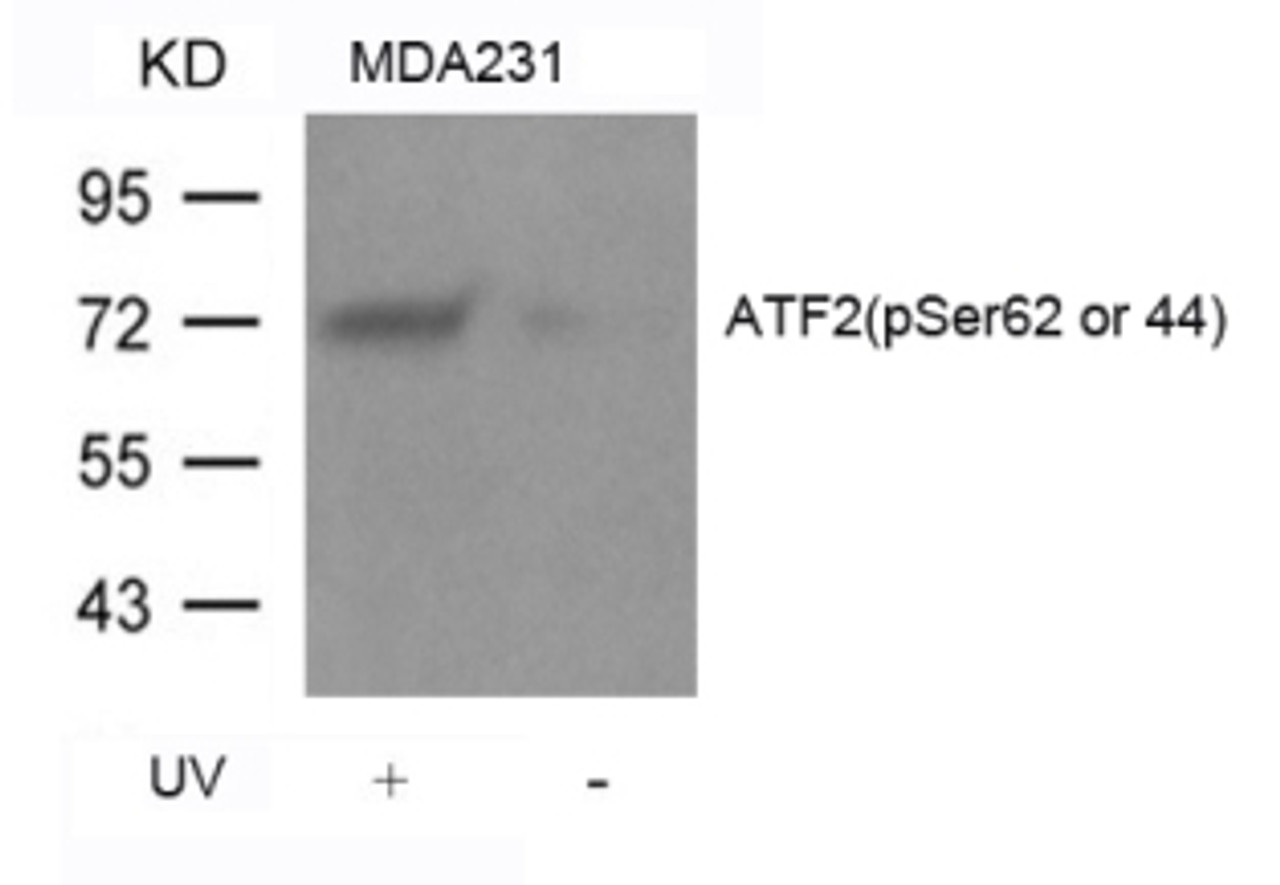 Western blot analysis of lysed extracts from MDA231 cells untreated or treated with UV using ATF2 (Phospho-Ser62 or 44) .