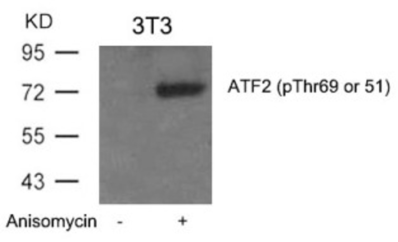 Western blot analysis of lysed extracts from 3T3 cells untreated or treated with Anisomycin using ATF2 (Phospho-Thr69 or 51) .