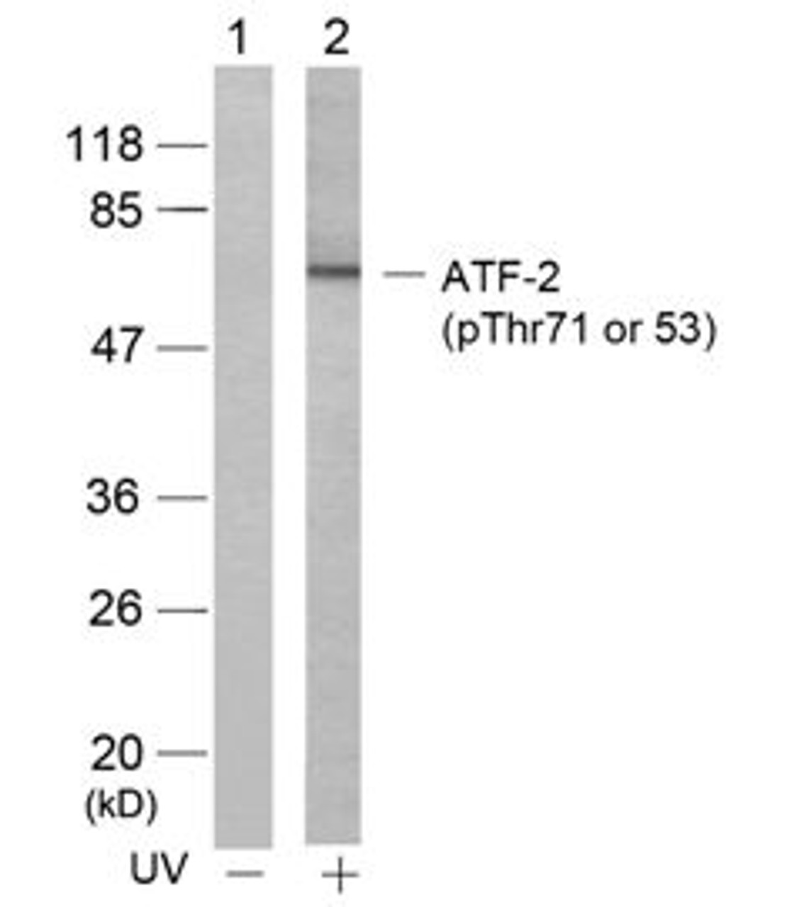 Western blot analysis of lysed extracts from HeLa cells untreated (Lane 1) or treated with UV (lane 2) using ATF2 (Phospho-Thr71 or 53) .