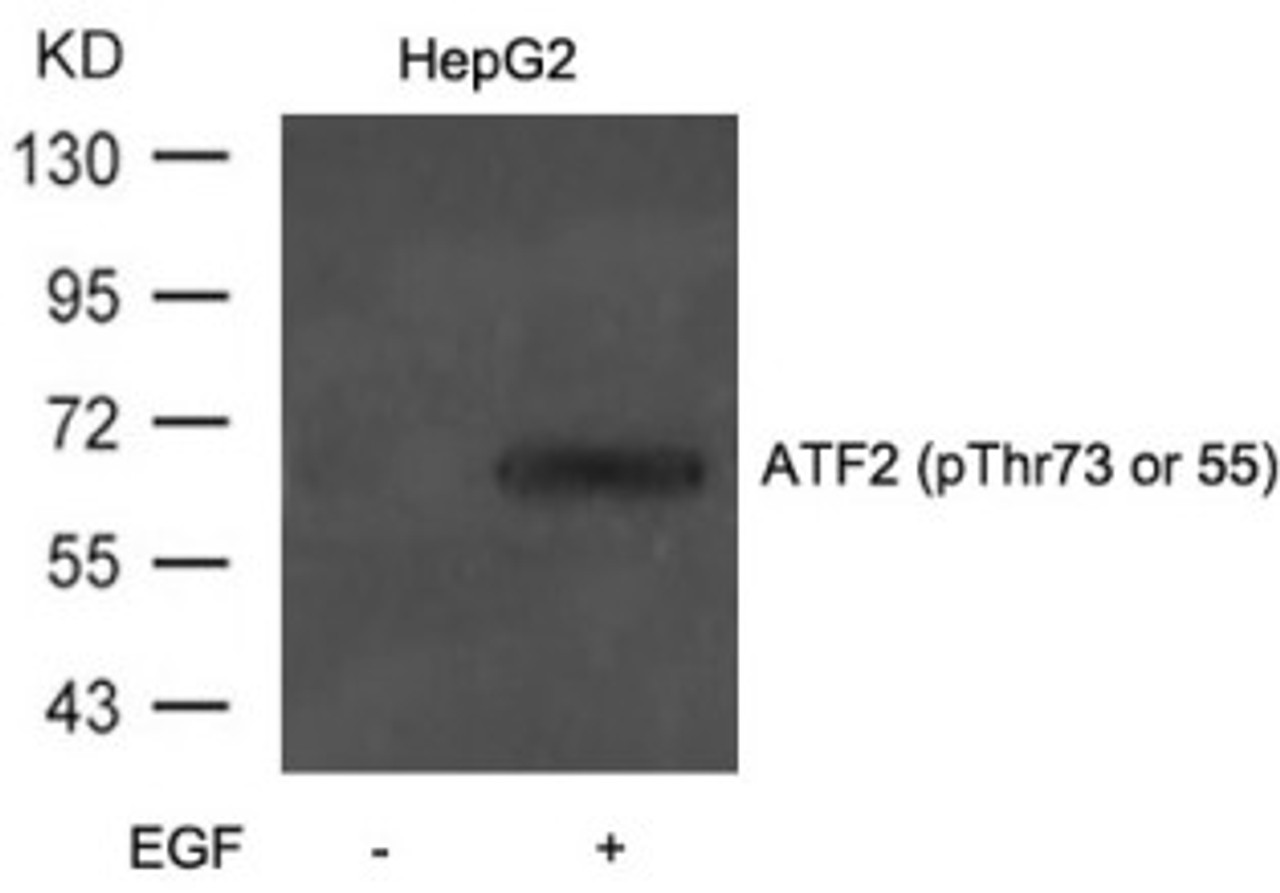 Western blot analysis of lysed extracts from HepG2 cells untreated or treated with EGF using ATF2 (Phospho-Thr71 or 53) .