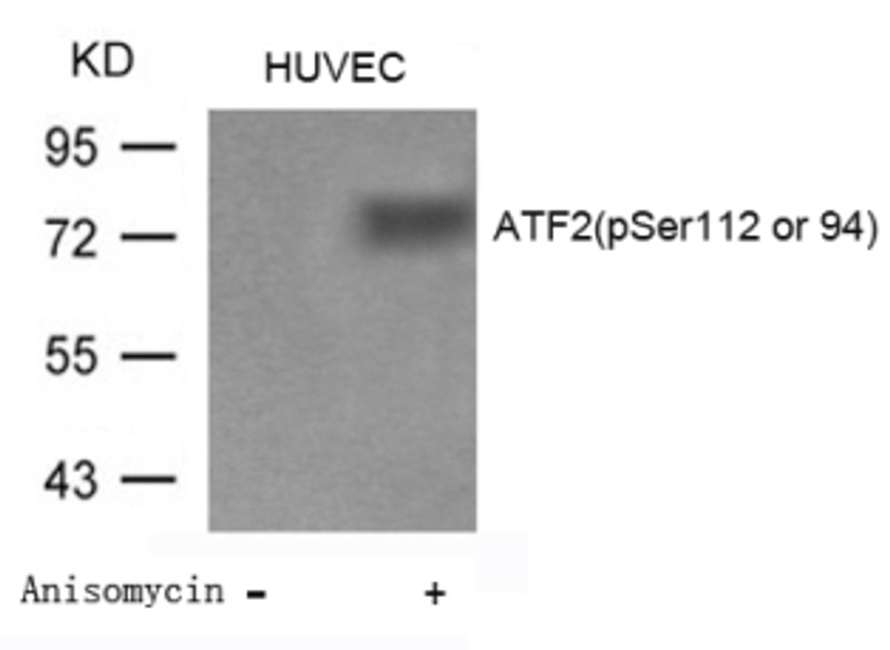 Western blot analysis of lysed extracts from Huvec cells untreated or treated with Anisomycin using ATF2 (Phospho-Ser112 or 94) .