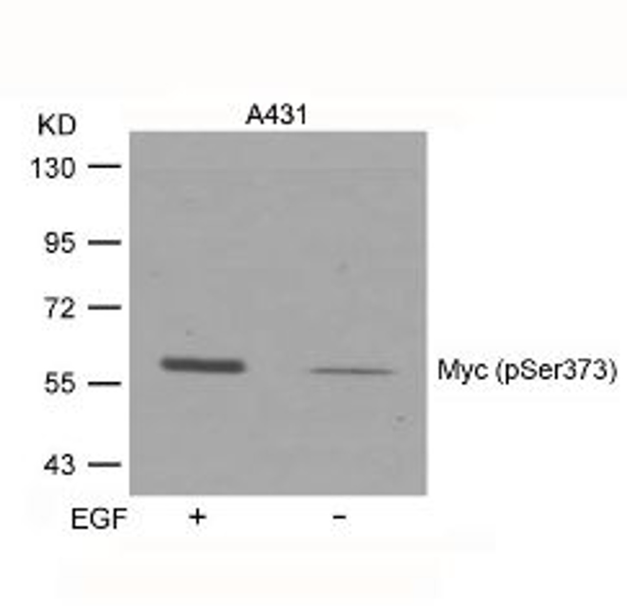 Western blot analysis of lysed extracts from A431 cells untreated or treated with EGF using Myc (Phospho-Ser373) .