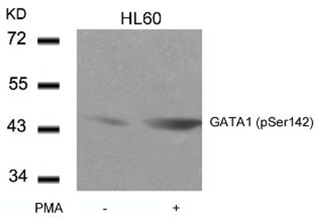 Western blot analysis of lysed extracts from HL60 cells untreated or treated with PMA using GATA1 (Phospho-Ser142) .