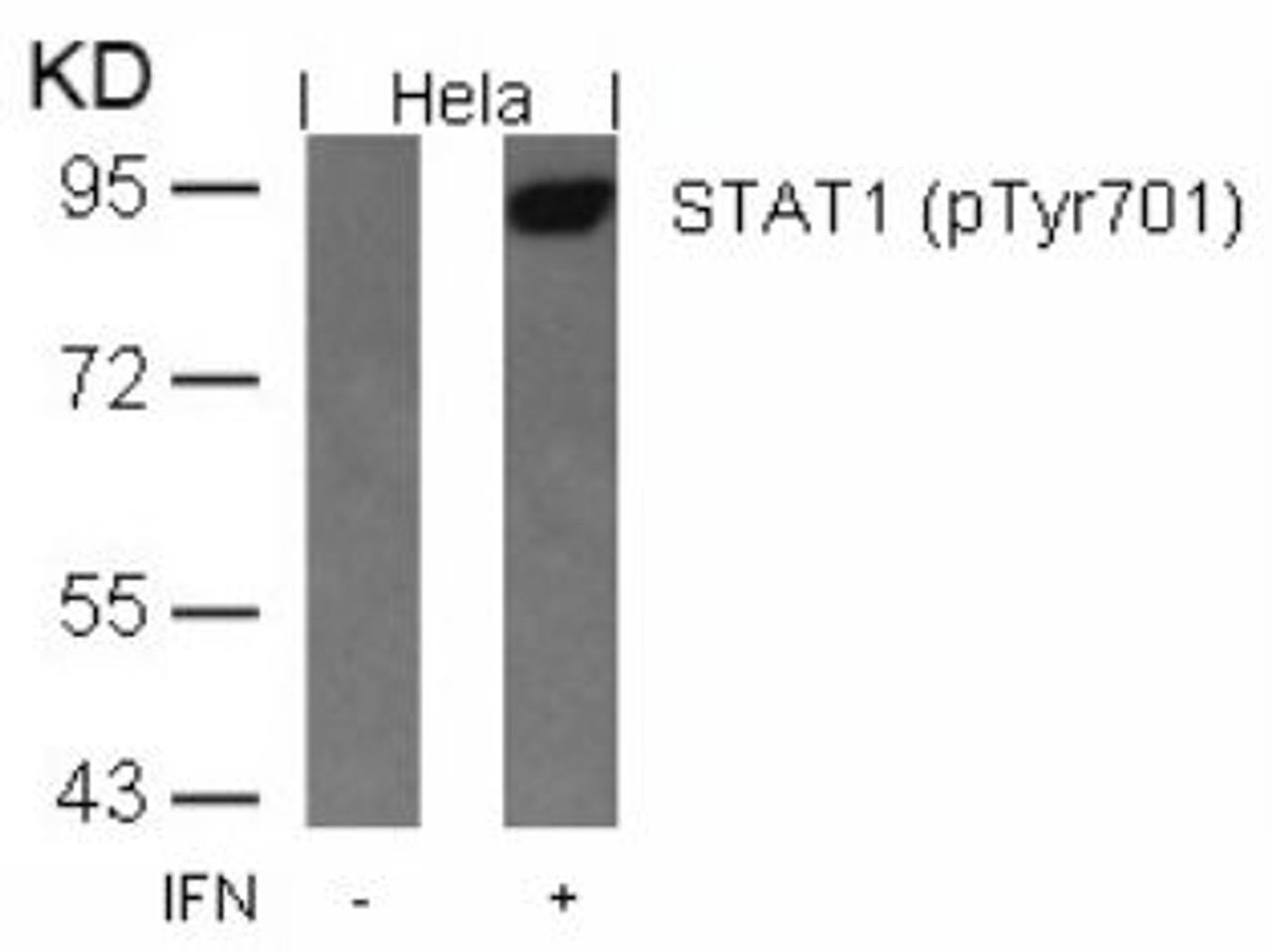Western blot analysis of lysed extracts from HeLa cells untreated or treated with IFN using STAT1 (Phospho-Tyr701) .
