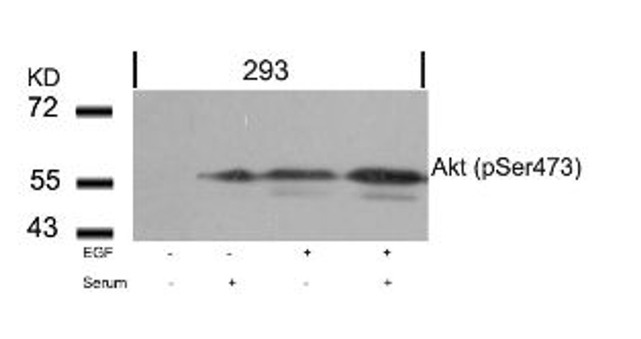 Western blot analysis of lysed extracts from 293 cells untreated or treated with EGF, Serum or both using Akt (Phospho-Ser473) .