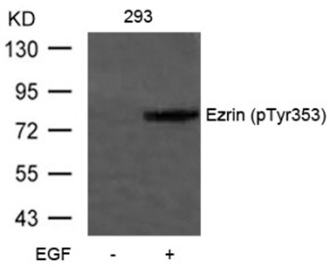 Western blot analysis of lysed extracts from 293 cells untreated or treated with EGF using Ezrin (Phospho-Tyr353) .