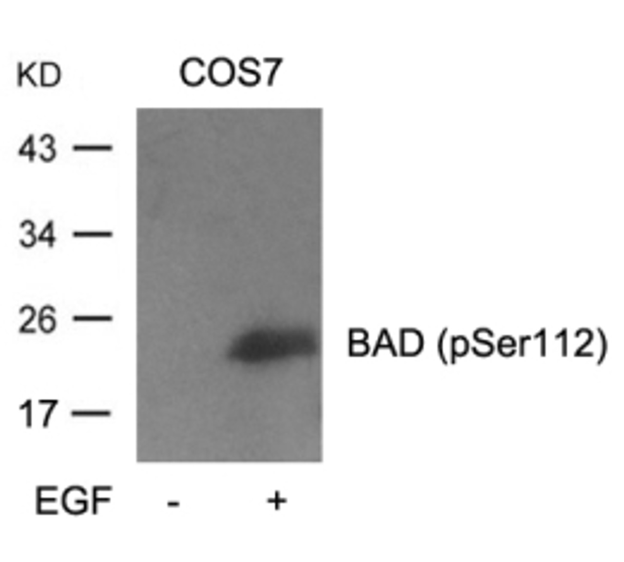 Western blot analysis of lysed extracts from cos7 cells untreated or treated with EGF using BAD (Phospho-Ser112) .