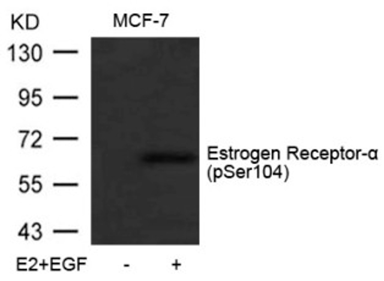 Western blot analysis of lysed extracts from MCF-7 cells untreated or treated with E2 and EGF using Estrogen Receptor-&#945; (Phospho-Ser104) .