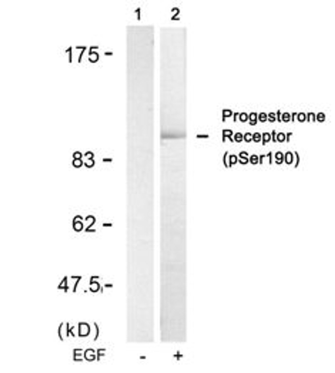 Western blot analysis of lysed extracts from SKOV3 cells untreated (Lane 1) or treated with EGF (lane 2) using Progesterone Receptor (Phospho-Ser190) .