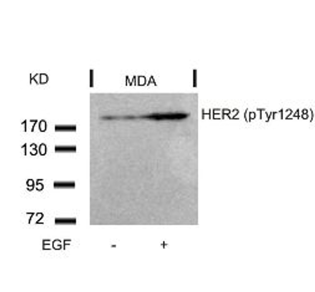 Western blot analysis of lysed extracts from MDA cells untreated or treated with EGF using HER2 (Phospho-Tyr1248) .