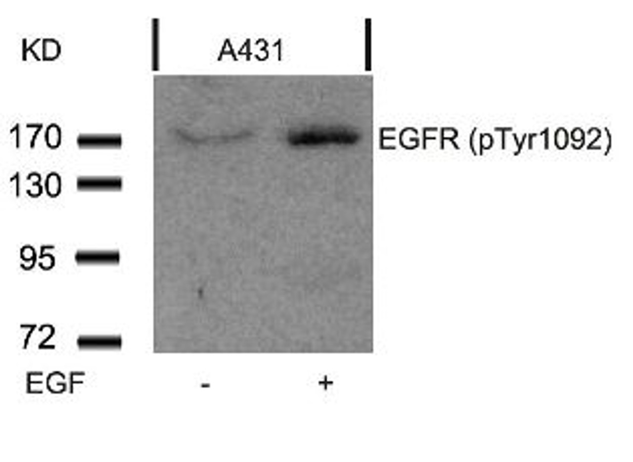 Western blot analysis of lysed extracts from A431 cells untreated or treated with EGF using EGFR (Phospho-Tyr1092) .