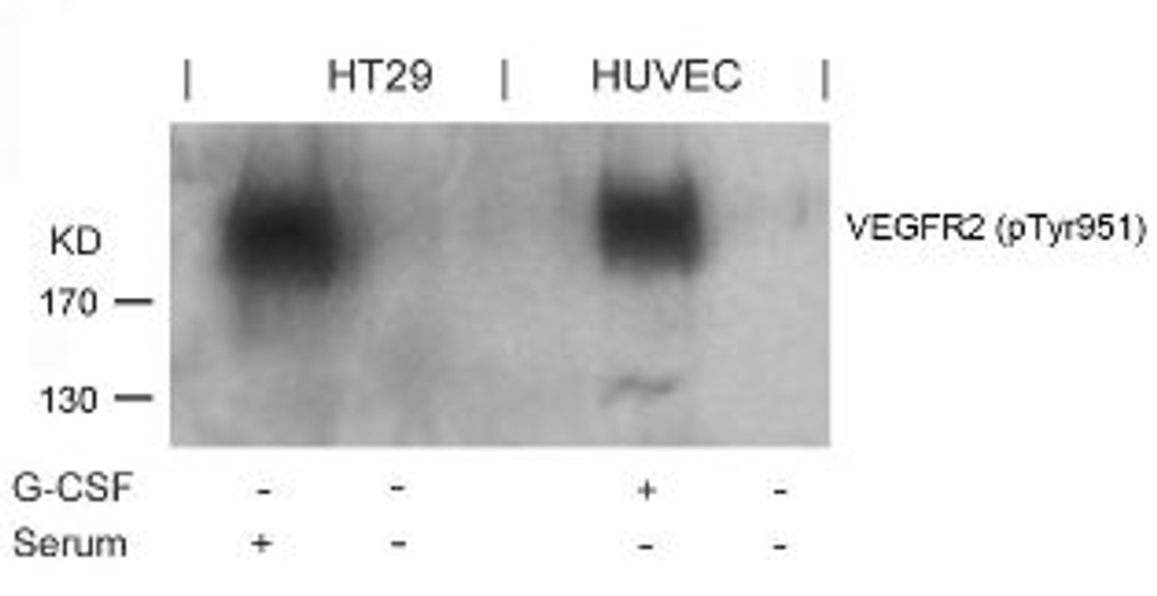 Western blot analysis of lysed extracts from G-CSF-treated HUVEC and serum-treated HT29 cells using VEGFR2 (Phospho-Tyr951) .