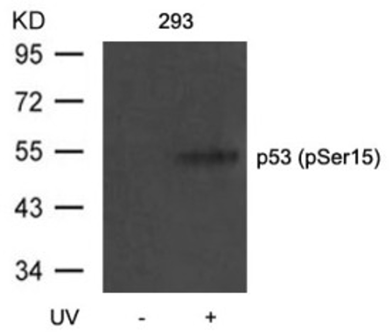 Western blot analysis of lysed extracts from 293 cells untreated or treated with UV using p53 (Phospho-Ser15) .