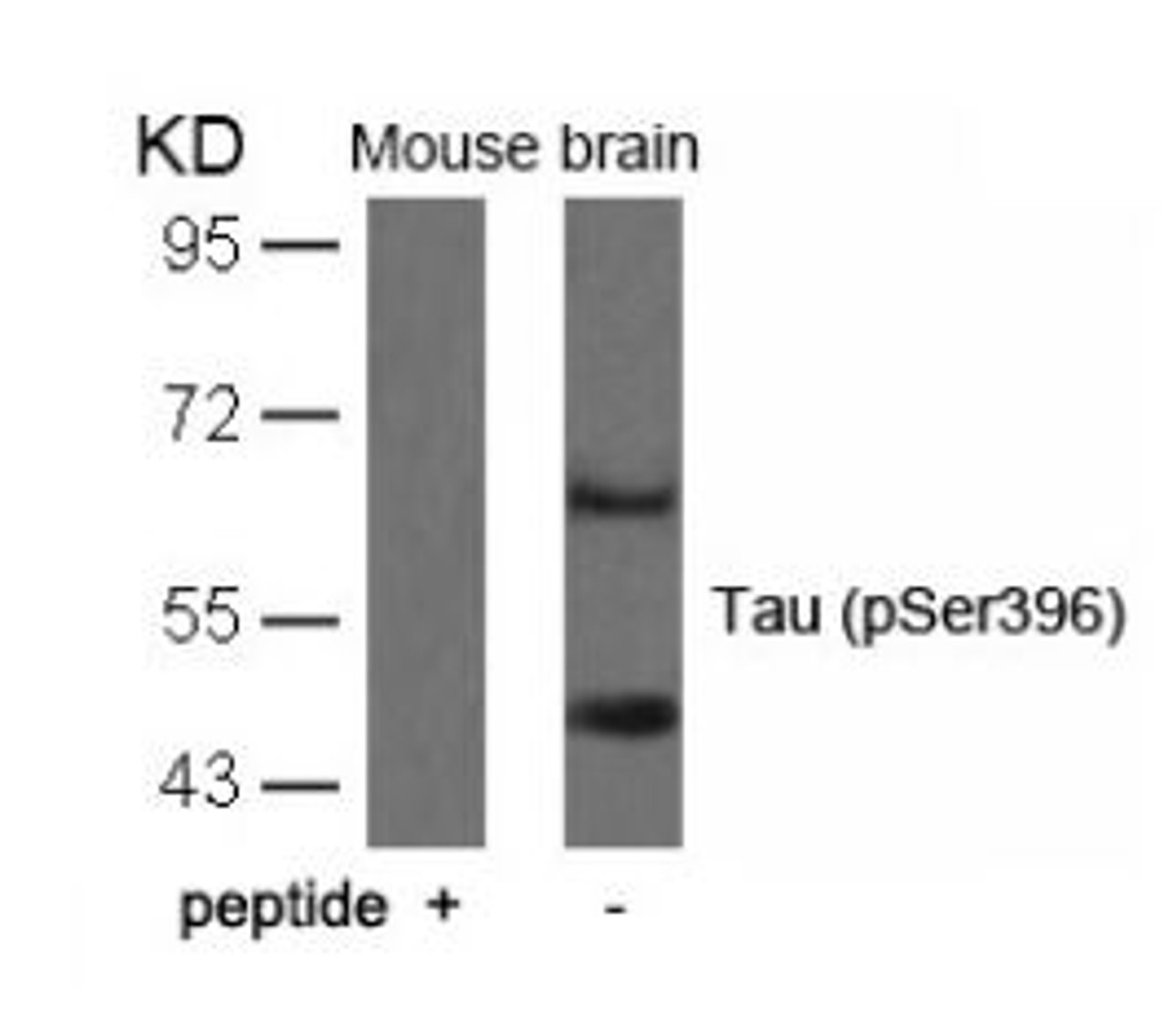 Western blot analysis of lysed extracts from mouse brain tissue using Tau (Phospho-Ser396) .