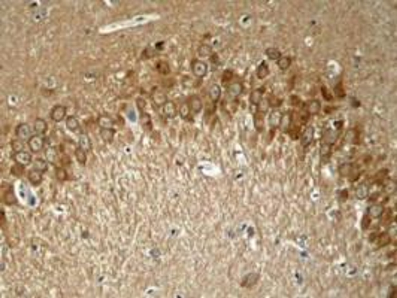Immunohistochemical analysis of paraffin-embedded rat hippocampal region tissue from a model with Alzheimer’s Disease using Tau (Phospho-Thr181) .