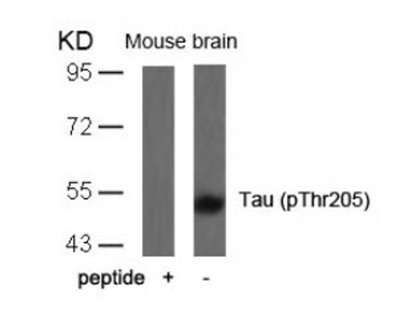 Western blot analysis of lysed extracts from mouse brain tissue using Tau (Phospho-Thr205) .