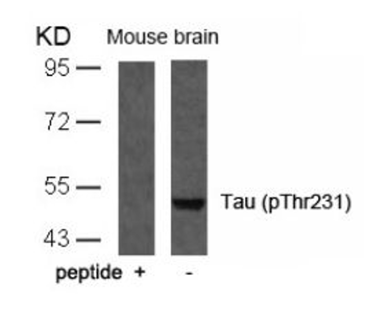 Western blot analysis of lysed extracts from mouse brain tissue using Tau (Phospho-Thr231) .