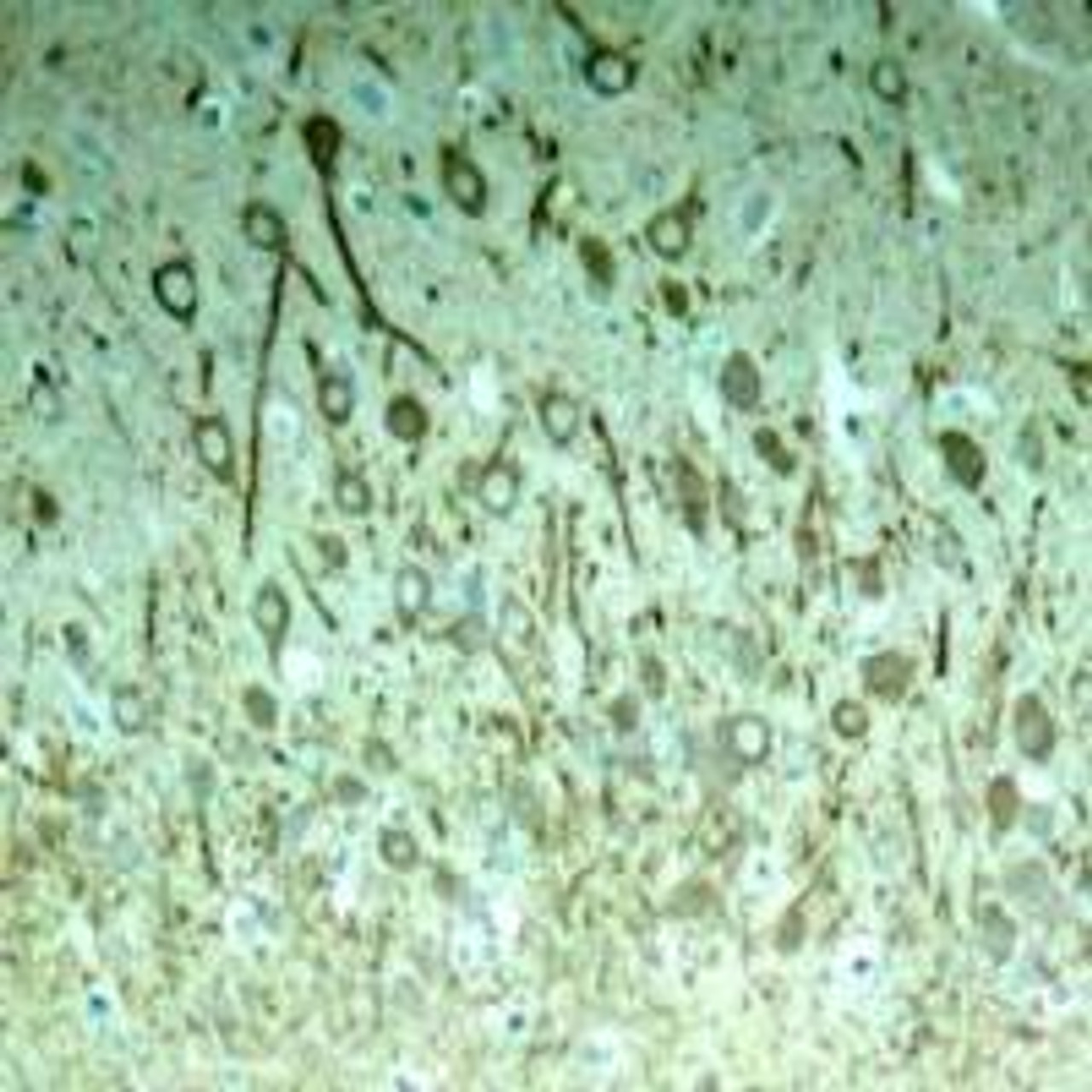 Immunohistochemical analysis of paraffin-embedded rat hippocampal region tissue from a model with Alzheimer’s Disease using Tau (Phospho-Thr231) .