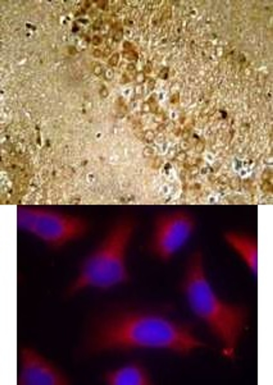 <b>Top Image:</b> Immunohistochemical analysis of paraffin-embedded rat hippocampal region tissue from a model with Alzheimer’s Disease using Tau (Phospho-Ser262) .<b>Bottom Image:</b> Immunofluorescence staining of methanol-fixed HeLa cells using Tau (Phospho-Ser262) .