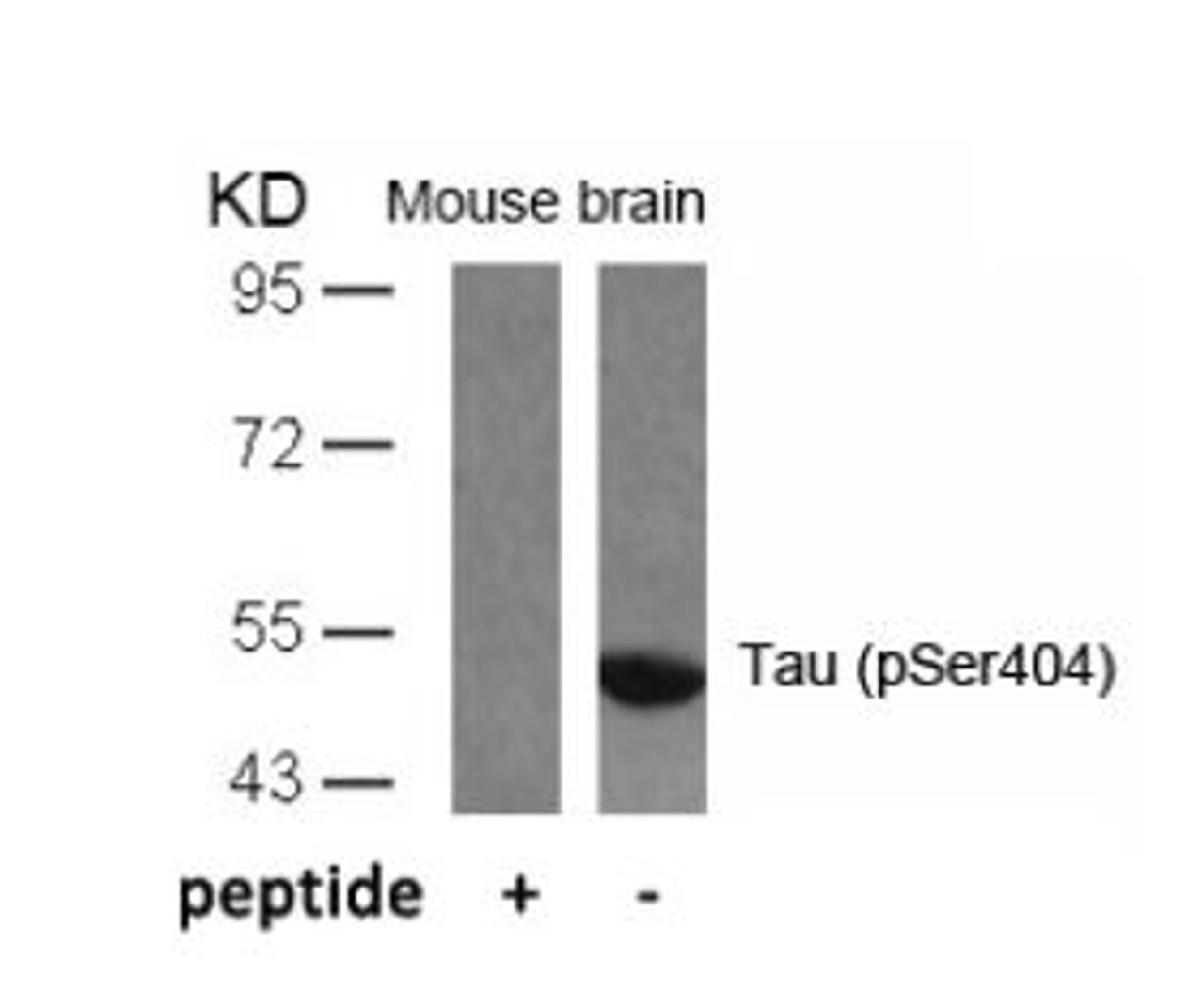 Western blot analysis of lysed extracts from mouse brain tissue using Tau (Phospho-Ser404) .