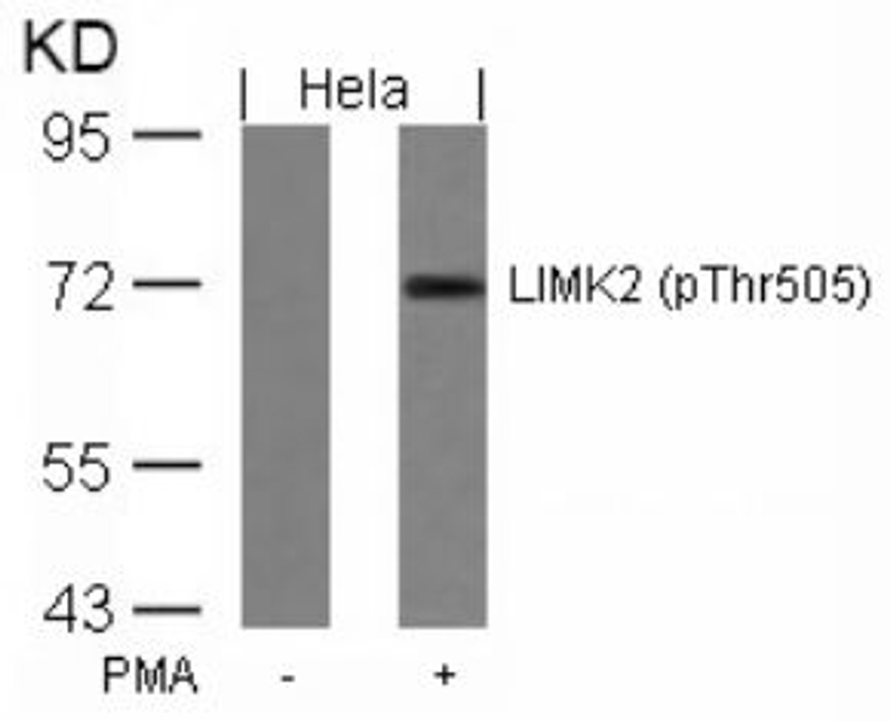 Western blot analysis of lysed extracts from HeLa cells untreated or treated with PMA using LIMK2 (Phospho-Thr505) .