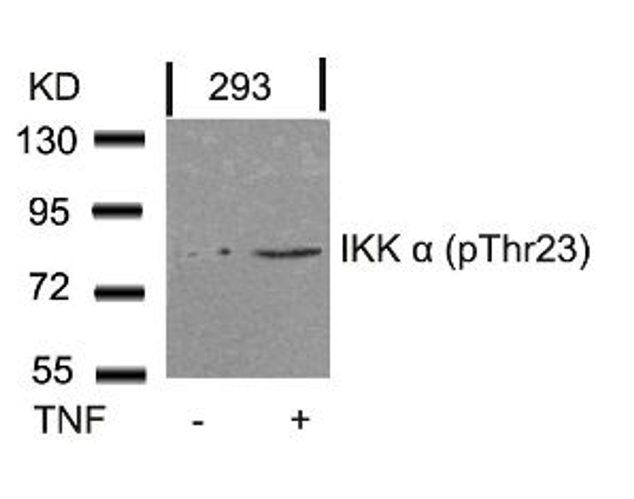 Western blot analysis of lysed extracts from 293 cells untreated or treated with TNF using IKK &#945; (Phospho-Thr23) .