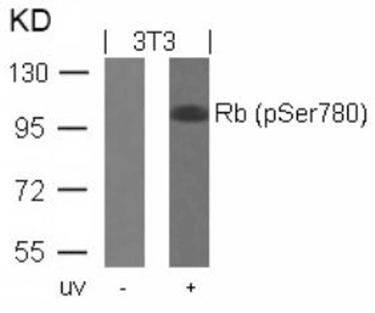 Western blot analysis of lysed extracts from 3T3 cells untreated or treated with UV using Rb (Phospho-Ser780) .