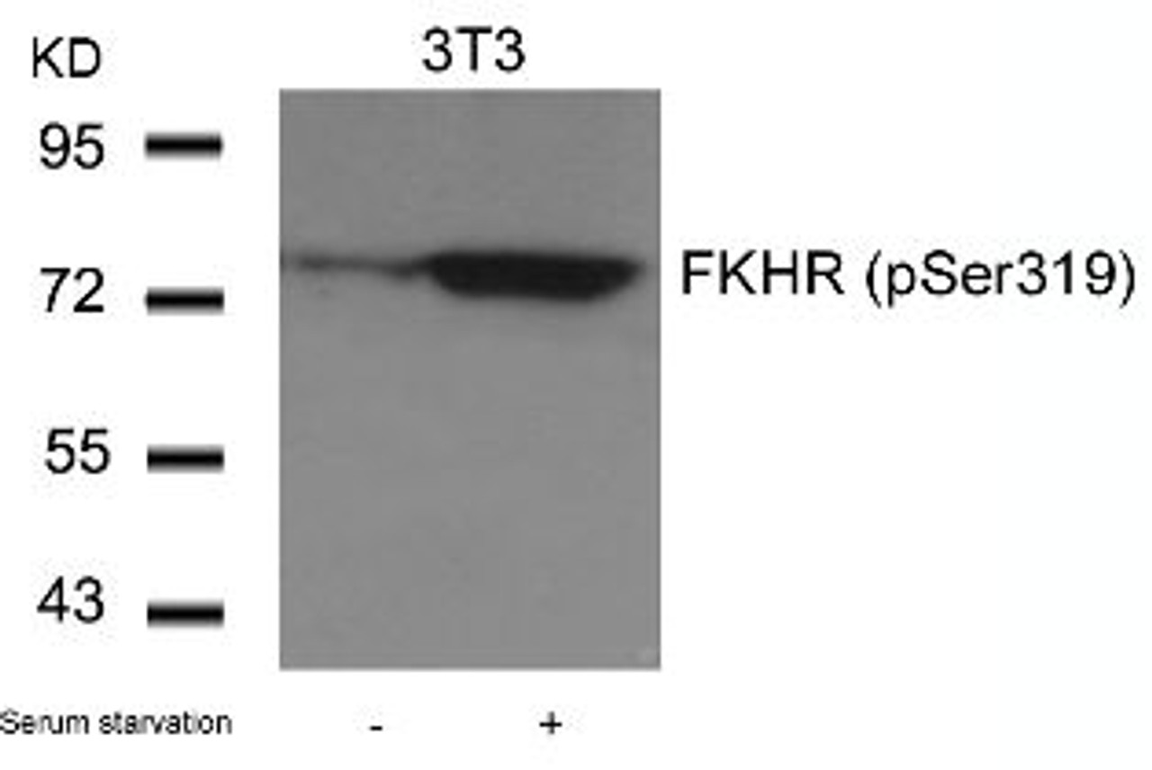 Western blot analysis of lysed extracts from 3T3 cells untreated or treated with serum starvation using FKHR (Phospho-Ser319) .