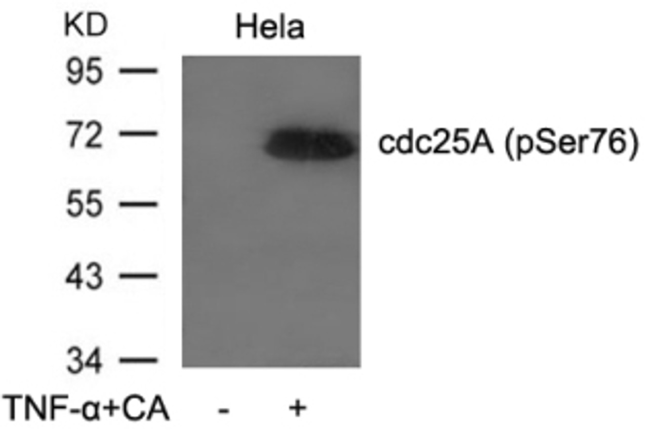 Western blot analysis of lysed extracts from HeLa cells untreated or treated with TNF-&#945; and CA using cdc25A (Phospho-Ser76) .