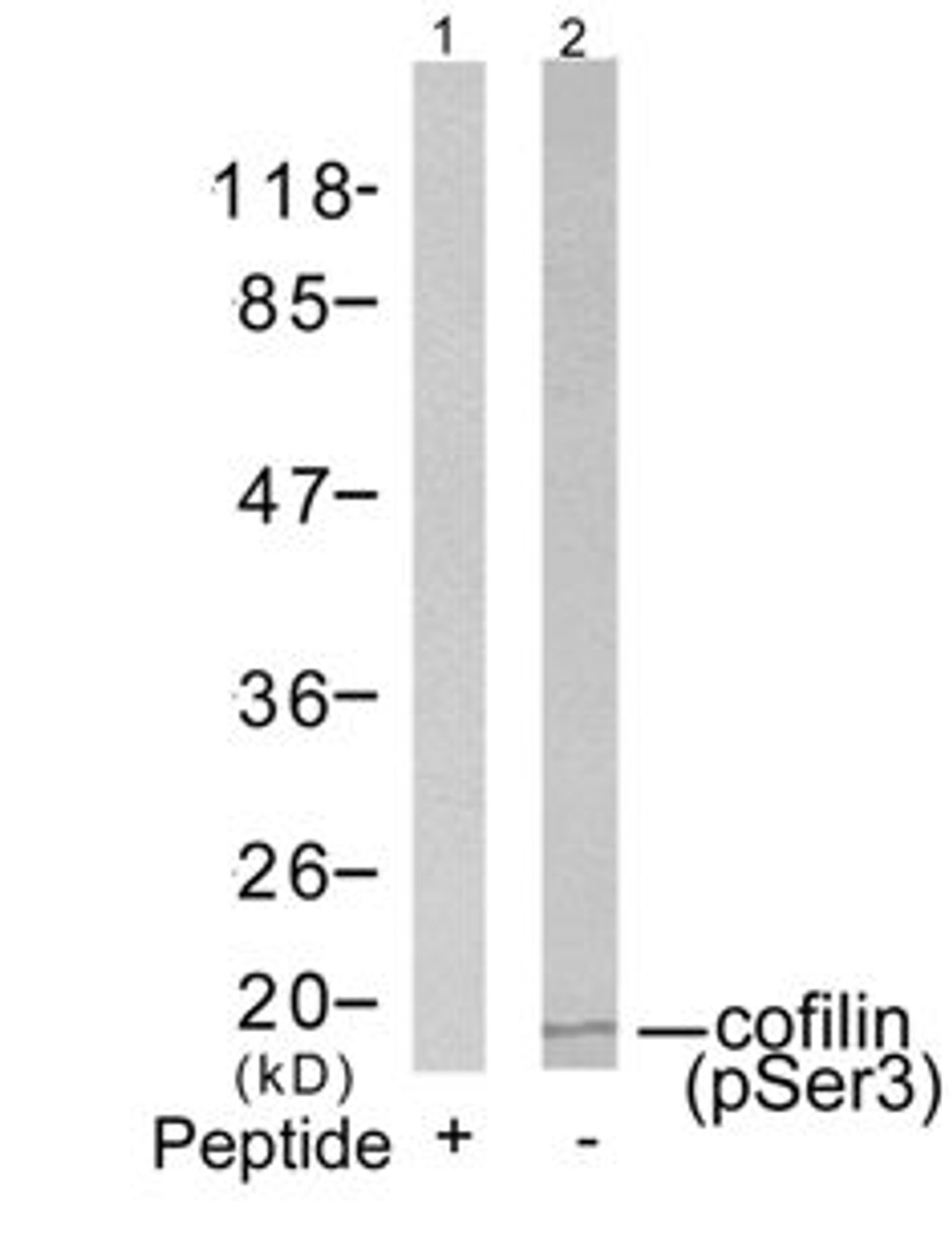 Western blot analysis of lysed extracts from COLO205 cells using cofilin (Phospho-Ser3) .