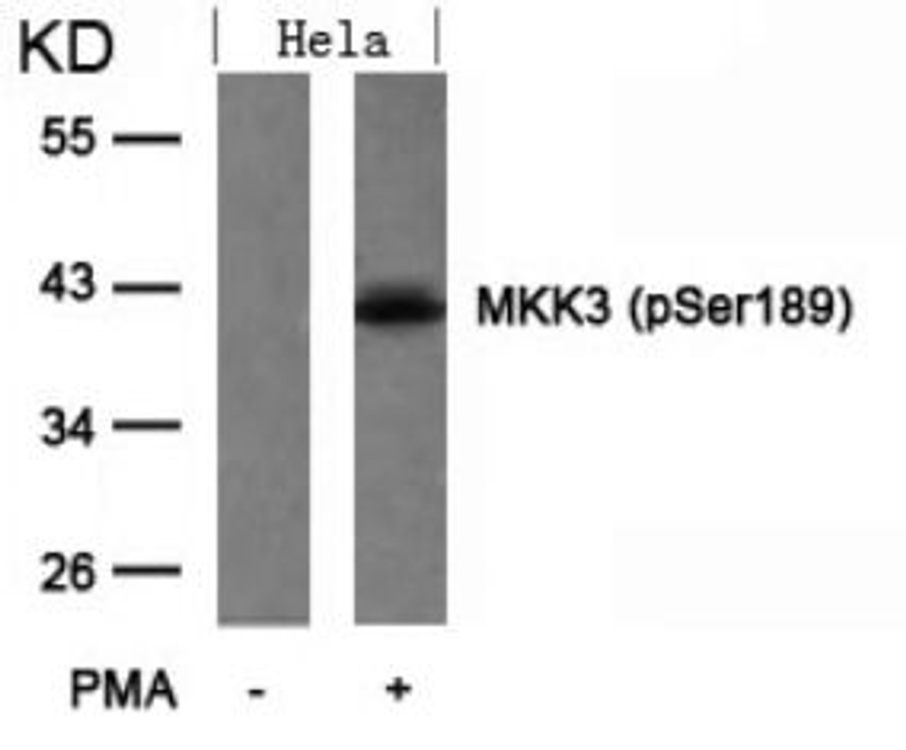 Western blot analysis of lysed extracts from HeLa cells untreated or treated with PMA using MKK3 (Phospho-Ser189) .