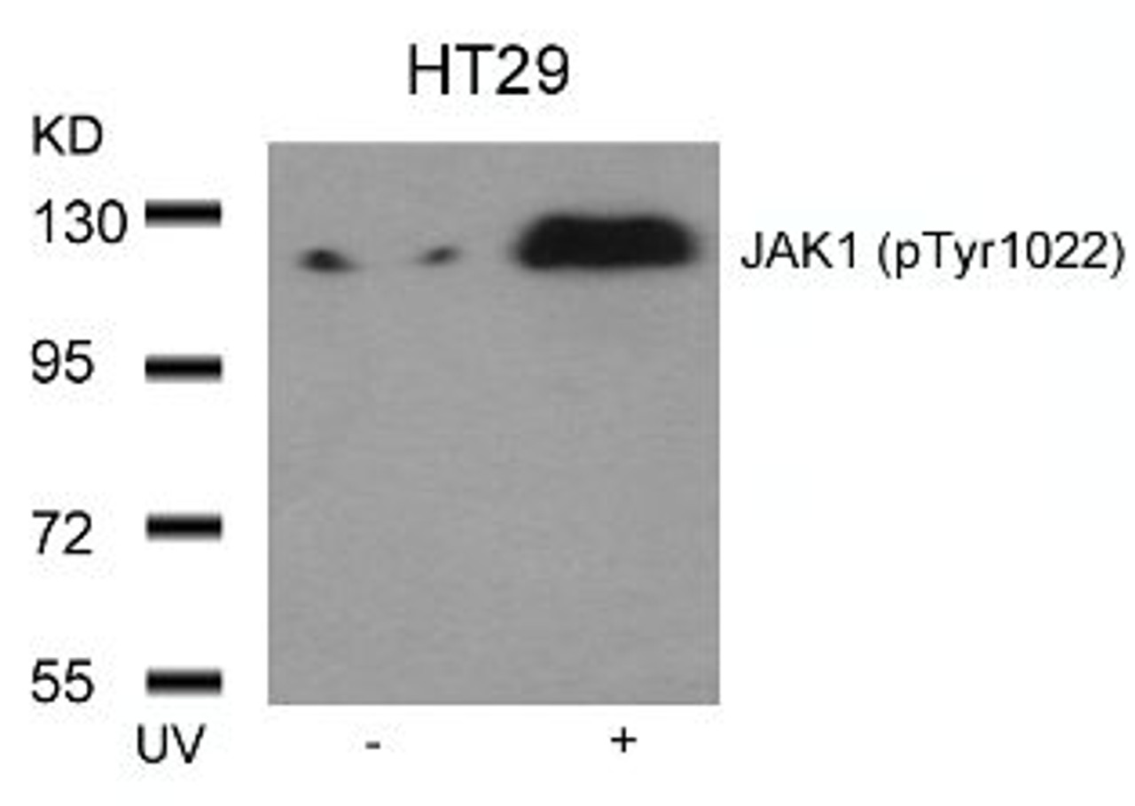 Western blot analysis of lysed extracts from HT29 cells untreated or treated with UV using JAK1 (Phospho-Tyr1022) .