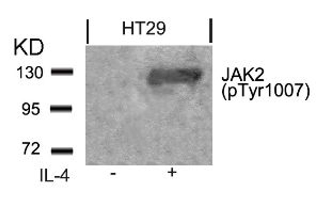 Western blot analysis of lysed extracts from HT29 cells untreated or treated with IL-4 using JAK2 (Phospho-Tyr1007) .